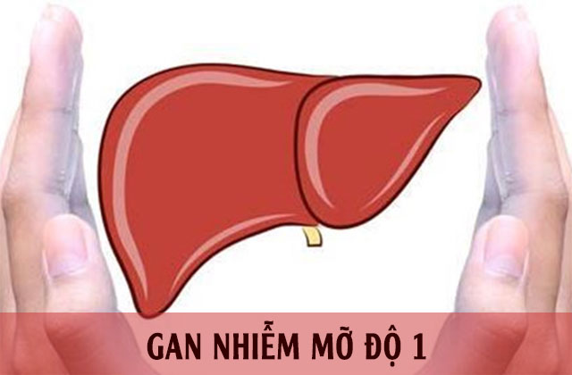 Bệnh gan nhiễm mỡ độ 1 là gì và cách phòng bệnh 1