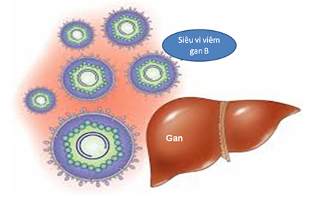 1. Có phải cứ nhiễm HBV là dùng thuốc? 1