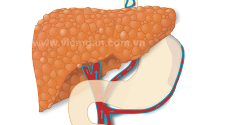 1. Chức năng của gan với cơ thể 1