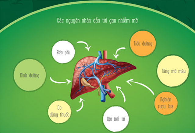 Nguyên nhân gây bệnh gan nhiễm mỡ 1