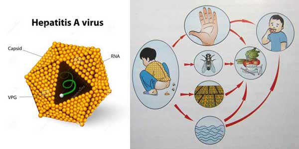 Nguyên nhân gây bệnh viêm gan A 1 Nguyên nhân gây bệnh viêm gan A 1