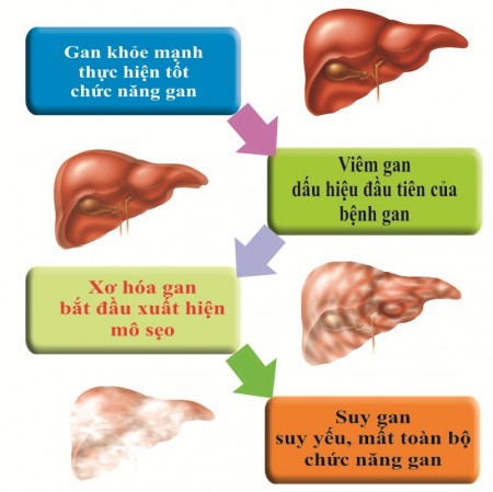 1. Viêm gan virus – bệnh hiểm chưa có phép trị 1 1. Viêm gan virus – bệnh hiểm chưa có phép trị 1