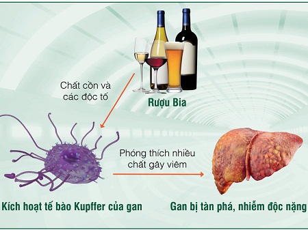 Tác hại của rượu bia lên người bệnh mắc viêm gan C