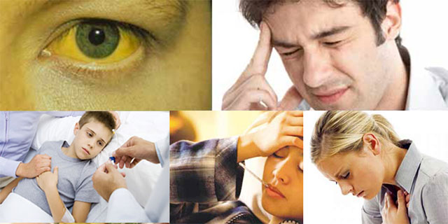 Triệu chứng viêm gan virus 1