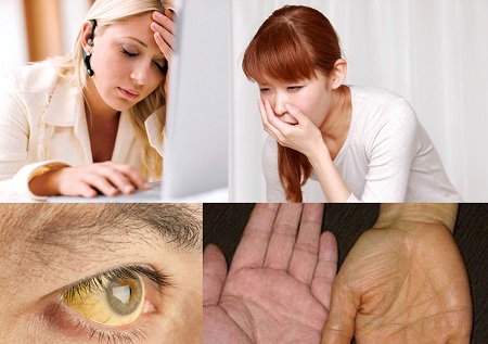 Bệnh viêm gan A có nguy hiểm gây tử vong không? 1 Bệnh viêm gan A có nguy hiểm gây tử vong không? 1