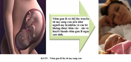 1- Lây truyền từ mẹ sang con: 1 1- Lây truyền từ mẹ sang con: 1