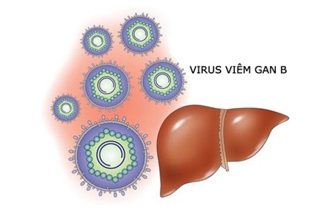 1. Viêm gan virus B – bệnh nguy hiểm nhưng chưa có phép trị 1