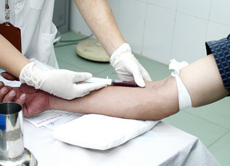 Làm thế nào để bảo vệ lá gan của bạn ? 9 Làm thế nào để bảo vệ lá gan của bạn ? 9