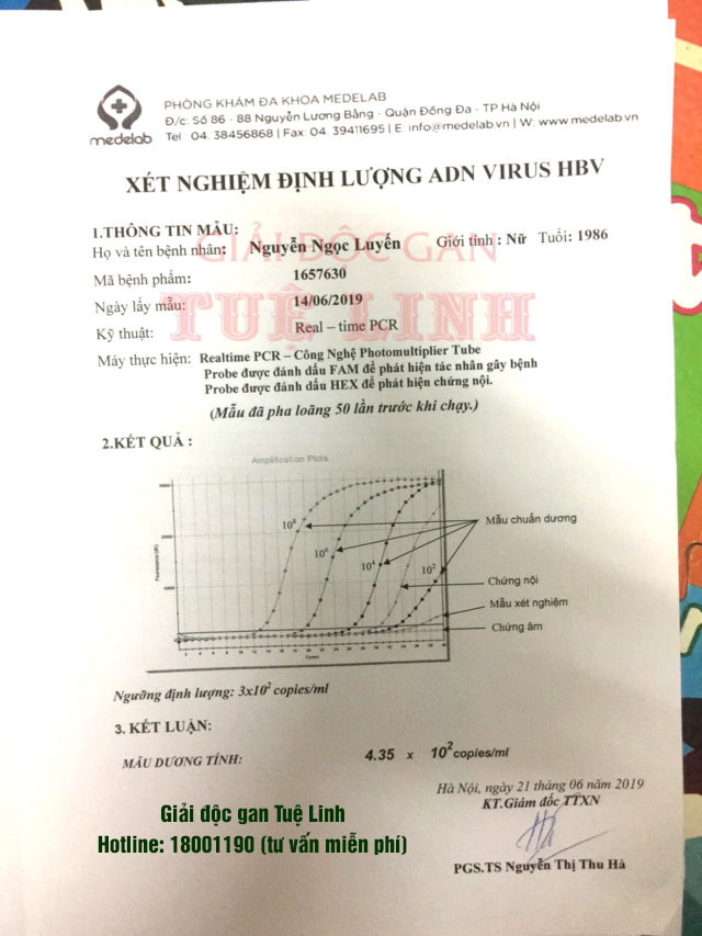 Suy kiệt vì tái phát viêm gan b sau sinh, may mắn cho cô gái gặp được bác sĩ giỏi - chuyên gia đầu ngành 2