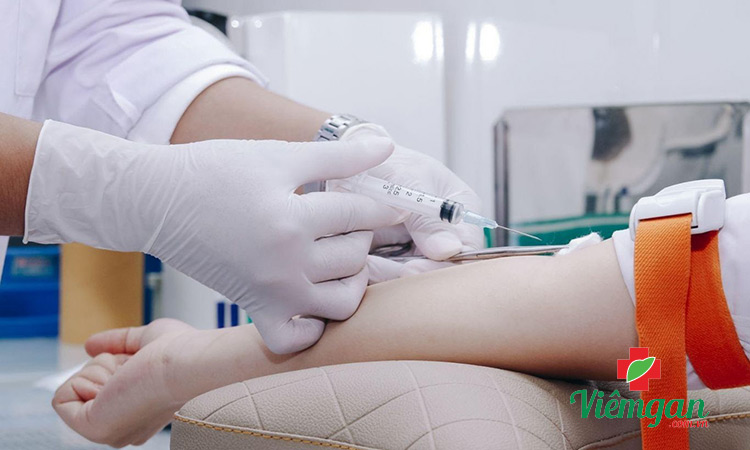 Giá xét nghiệm viêm gan B tại các cơ sở 1