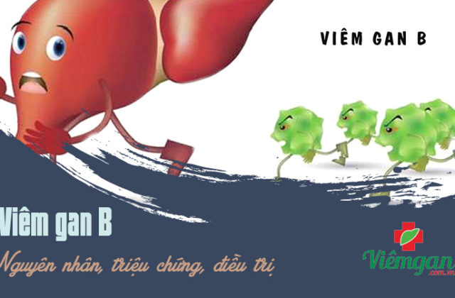 Viêm gan B – Nguyên nhân, triệu chứng và cách điều trị Viêm gan B – Nguyên nhân, triệu chứng và cách điều trị