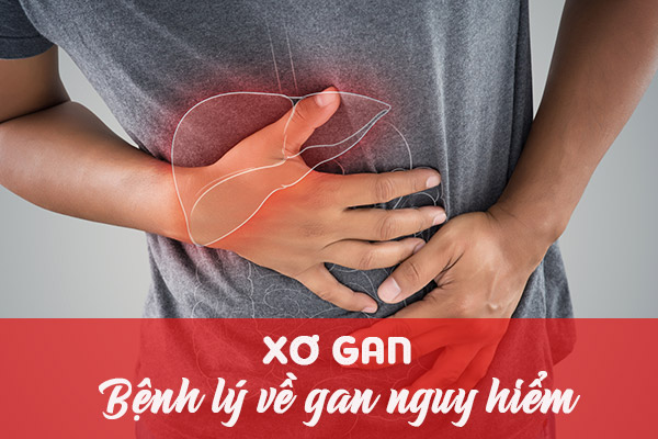 Bệnh án xơ gan cổ trướng và cách điều trị 1