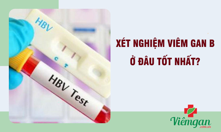 Xét nghiệm viêm gan B ở đâu tốt - Các địa chỉ làm xét nghiệm uy tín 1