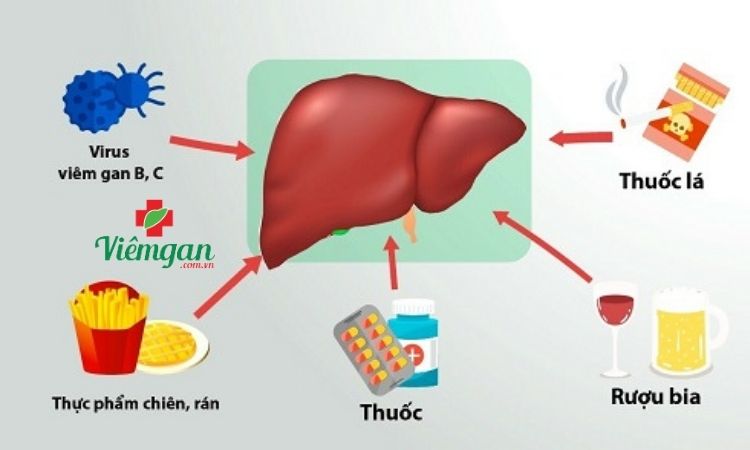 Nguyên nhân gây men gan cao 1