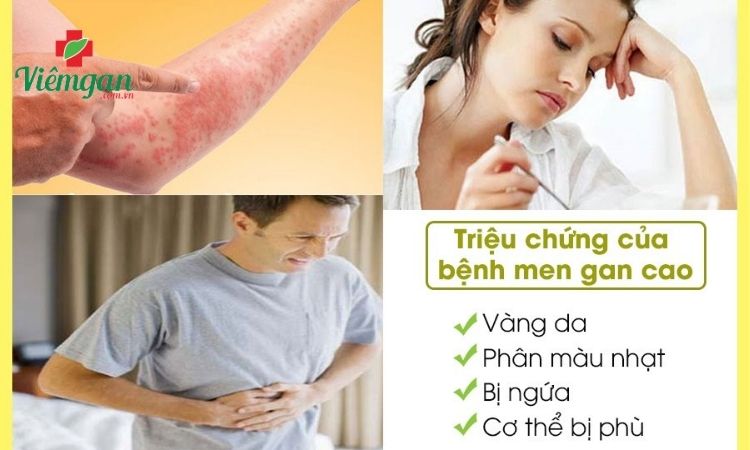 Men gan cao ảnh hưởng đến sức khỏe, sinh hoạt 1