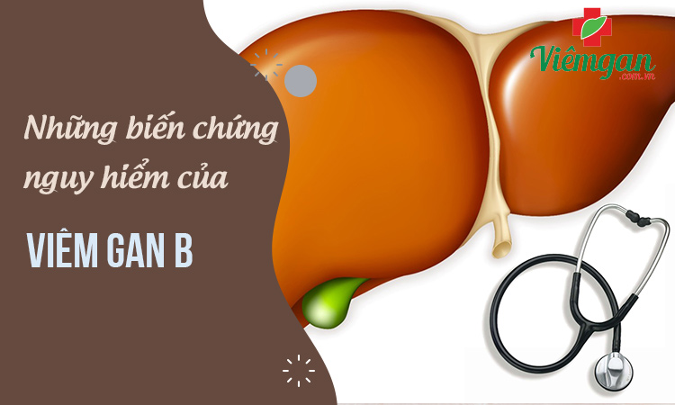 Các biến chứng nguy hiểm của viêm gan B 1 Các biến chứng nguy hiểm của viêm gan B 1