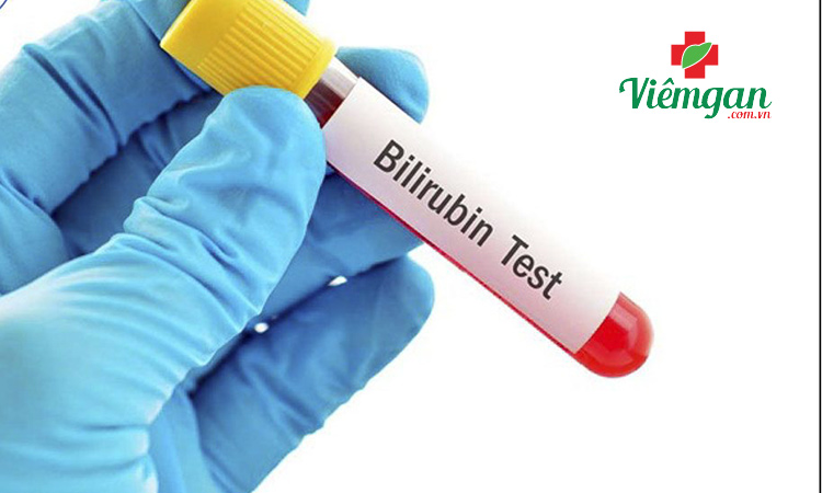 Chẩn đoán nguyên nhân vàng da như thế nào? 1 Chẩn đoán nguyên nhân vàng da như thế nào? 1