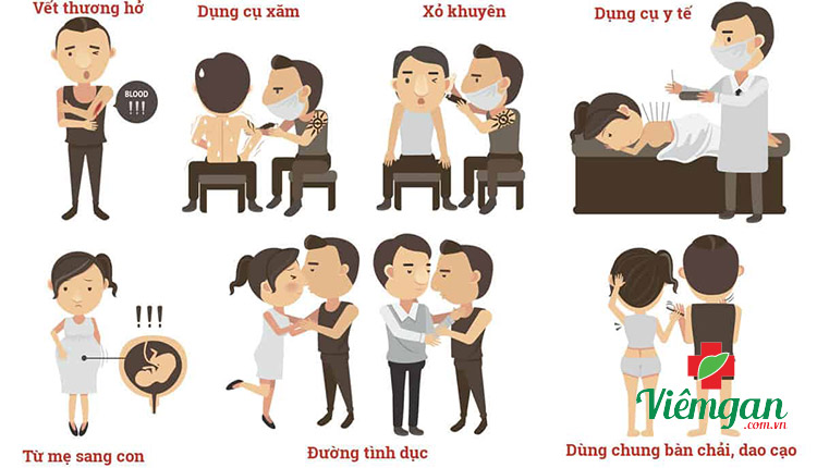 Viêm gan B lây qua đường nào? Có nguy hiểm không? 1 Viêm gan B lây qua đường nào? Có nguy hiểm không? 1