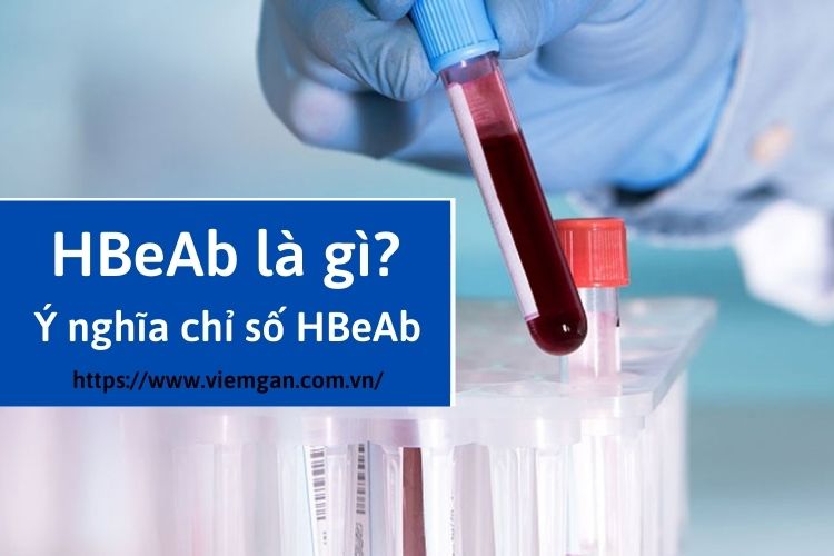 Xét nghiệm HBeAb là gì? Ý nghĩa chỉ số xét nghiệm HBeAb