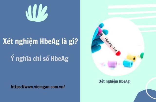 Xét nghiệm HbeAg là gì? Ý nghĩa HbeAg âm tính, dương tính Xét nghiệm HbeAg là gì? Ý nghĩa HbeAg âm tính, dương tính