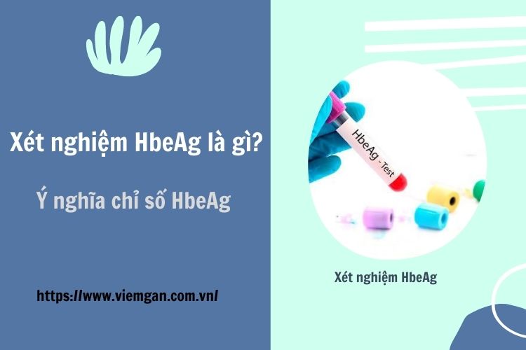 Xét nghiệm HbeAg là gì? Ý nghĩa HbeAg âm tính, dương tính 1