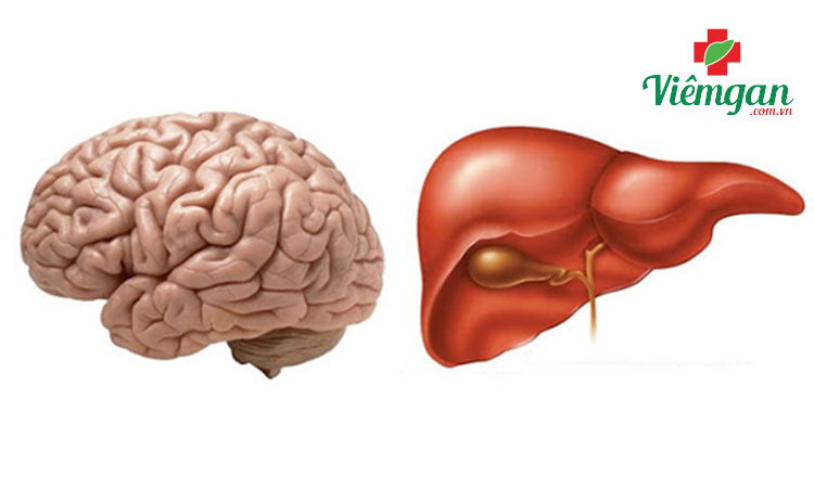 5. Bệnh não do gan 1 5. Bệnh não do gan 1