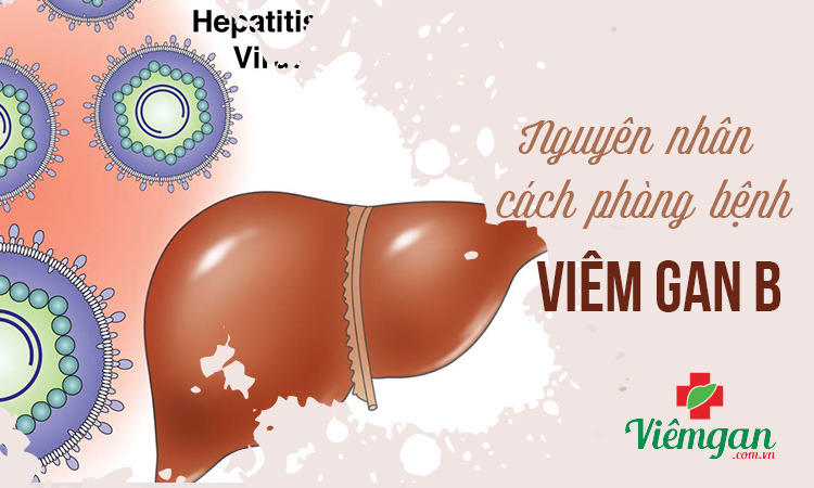 Nguyên nhân bị viêm gan b và cách phòng ngừa hiệu quả 1 Nguyên nhân bị viêm gan b và cách phòng ngừa hiệu quả 1