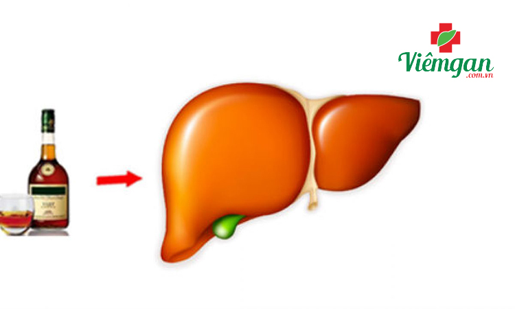 1. Nhóm bệnh liên quan đến tế bào gan (vàng da tại gan) 2 1. Nhóm bệnh liên quan đến tế bào gan (vàng da tại gan) 2