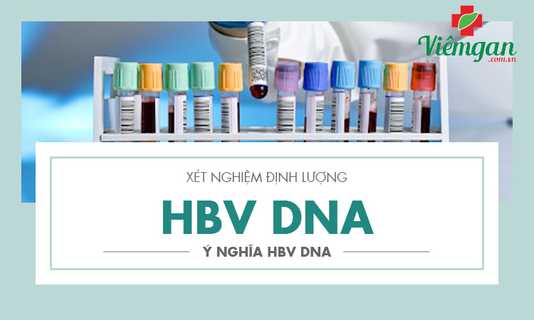 Xét nghiệm định lượng HBV-DNA là gì? Ý nghĩa định lượng HBV DNA 1