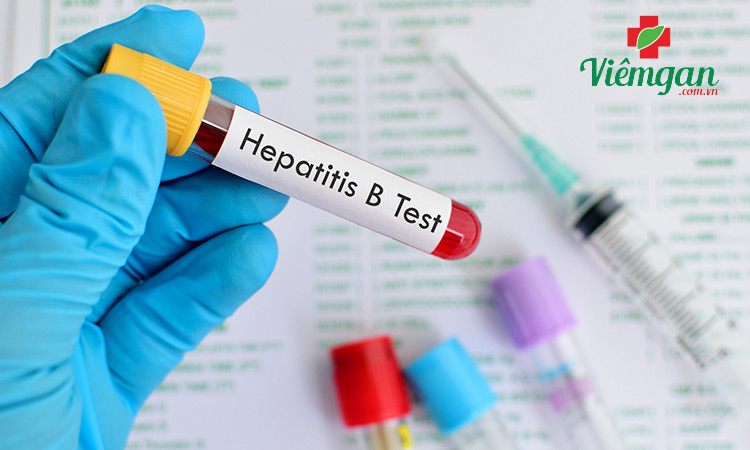 Những trường hợp cần xét nghiệm HBV-DNA 1