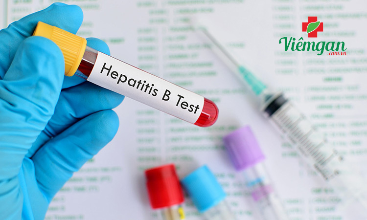 Các xét nghiệm thường được sử dụng để chẩn đoán viêm gan B 1