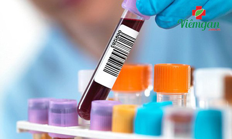 Xét nghiệm ALT là gì? 1