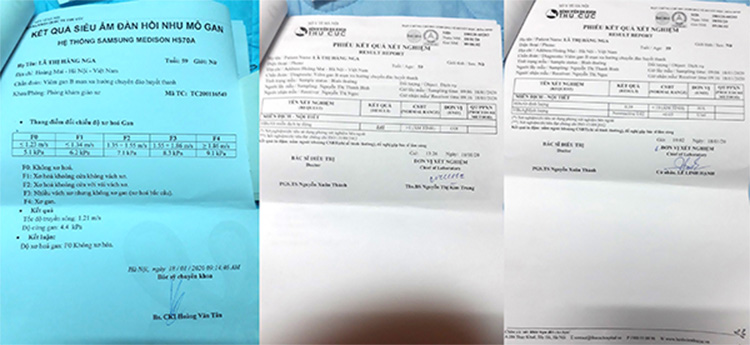 Âm tính với virus viêm gan B, xuất hiện quá trình chuyển đảo huyết thanh và tìm lại sức khỏe nhờ lời khuyên c 3