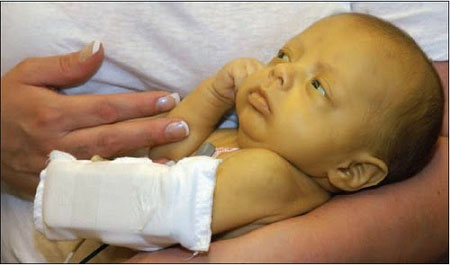 Phát hiện viêm gan C ở trẻ như thế nào? 1 Vì sao trẻ mắc viêm gan C