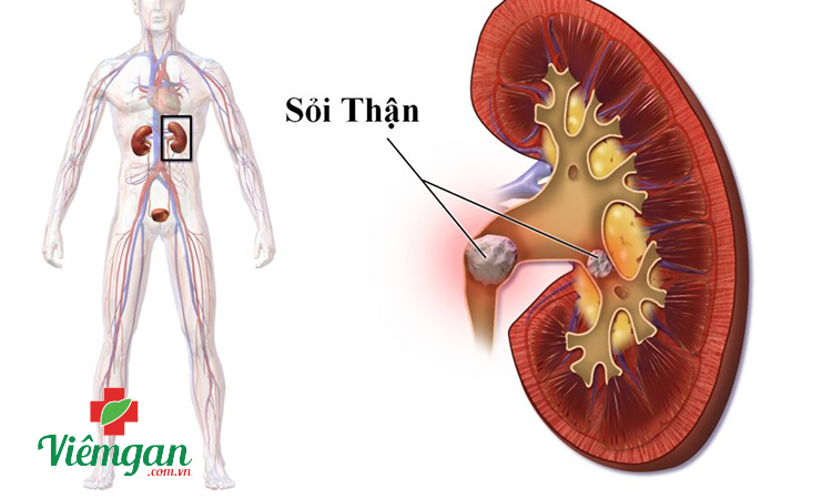 Một số bệnh về thận 1