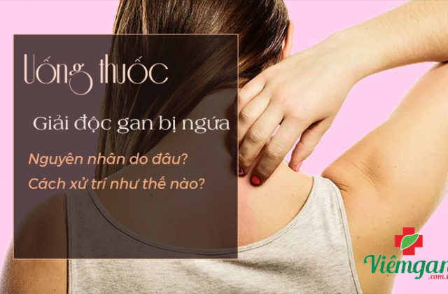 Uống thuốc giải độc gan bị ngứa do đâu? Uống thuốc giải độc gan bị ngứa do đâu?