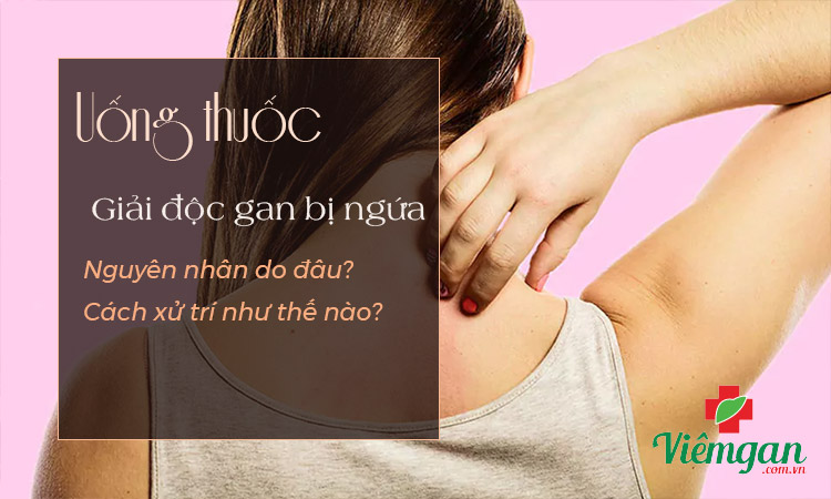 Uống thuốc giải độc gan bị ngứa do đâu? 1