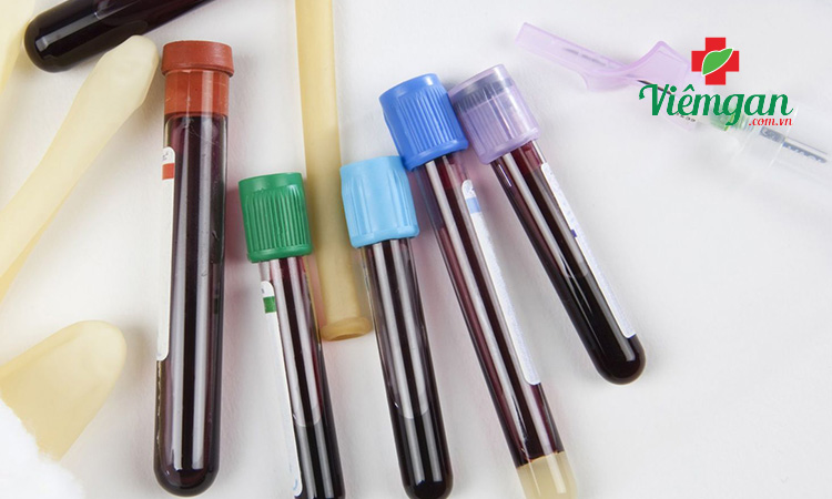 Xét nghiệm men gan gồm những gì? 1