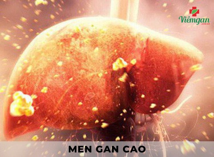 1. Thế nào là men gan cao? 1