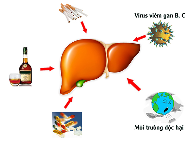 1. Viêm gan virus, xơ gan – Những bệnh nguy hiểm chưa có lời giải 1