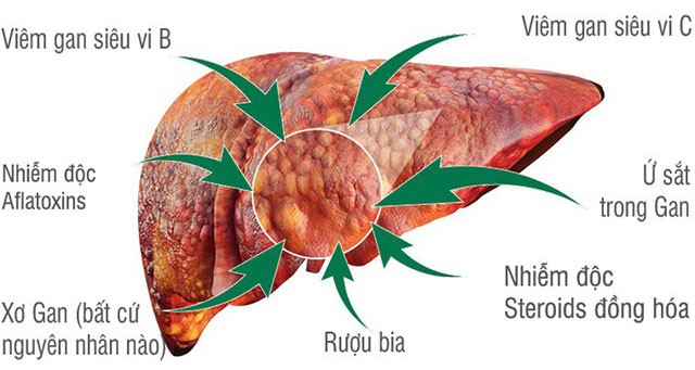 Muốn dùng thảo dược để hỗ trợ bảo vệ gan, Cà gai leo là một lựa chọn tốt 1