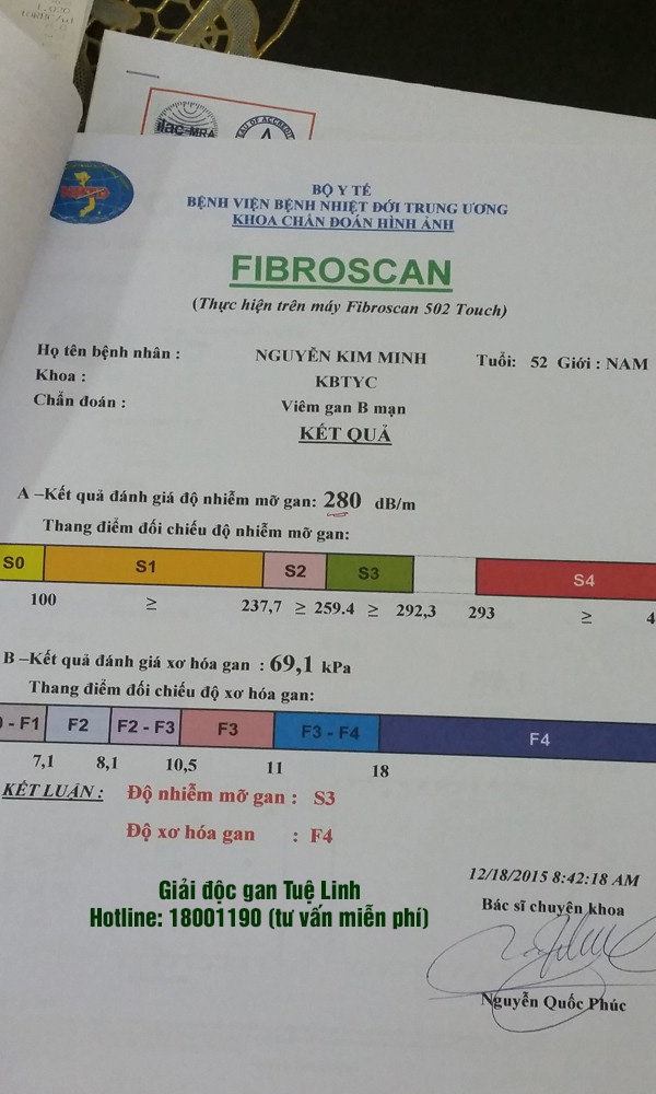1. Bình thản nhận “hung tin” 1 1. Bình thản nhận “hung tin” 1