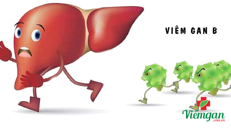 Do viêm gan virus 1 Do viêm gan virus 1