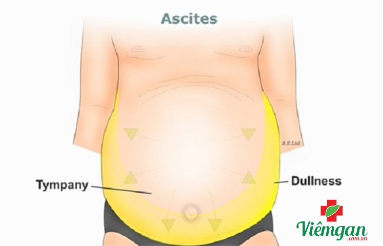 Dấu hiệu lâm sàng 2