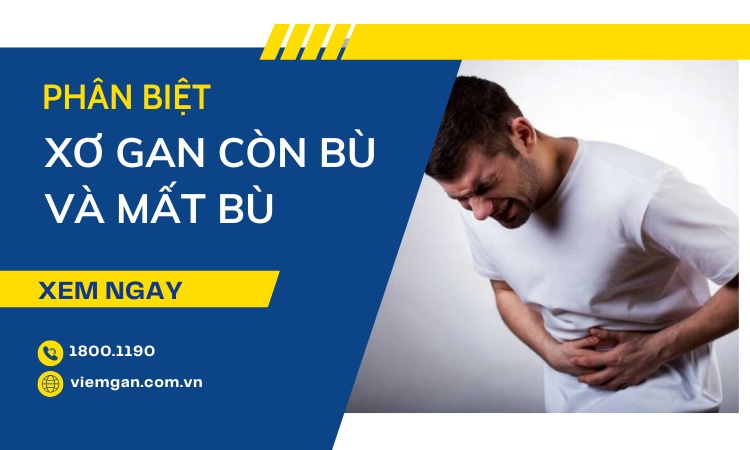 So sánh xơ gan còn bù và mất bù cực chi tiết! 1