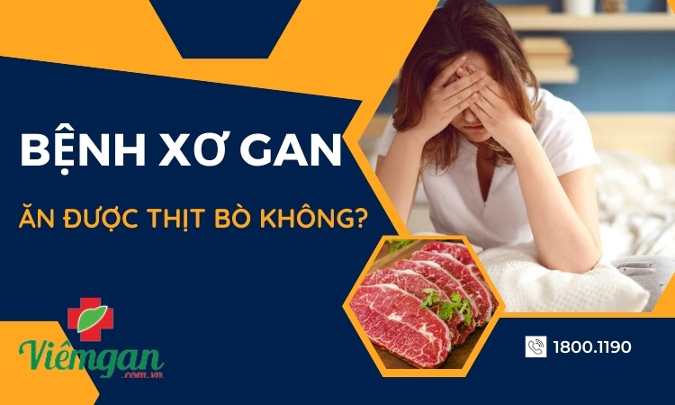 Bệnh xơ gan có ăn được thịt bò không? 1