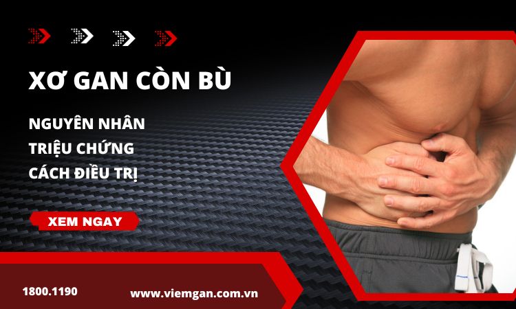 Xơ gan còn bù là gì: Nguyên nhân, triệu chứng, điều trị 1