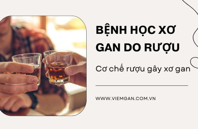 Bệnh học xơ gan do rượu – Những điều cần biết Bệnh học xơ gan do rượu – Những điều cần biết