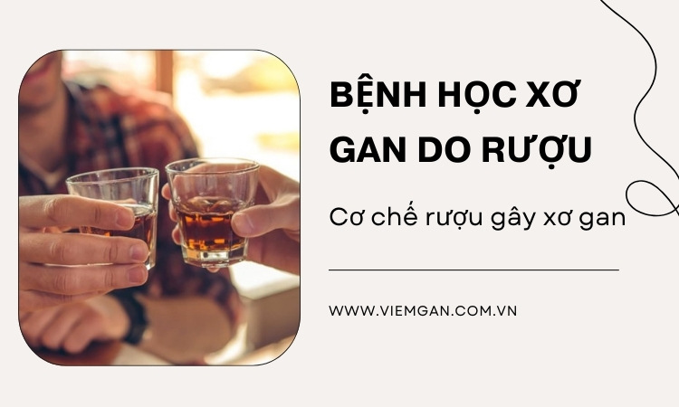 Bệnh học xơ gan do rượu - Những điều cần biết 1