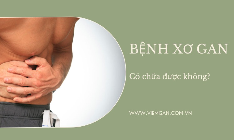 Bệnh xơ gan có chữa được không? 1 Bệnh xơ gan có chữa được không? 1